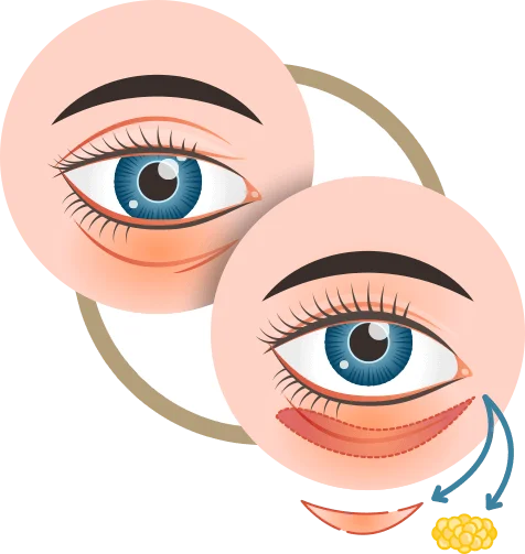 Ícone Pálpebra Inferior